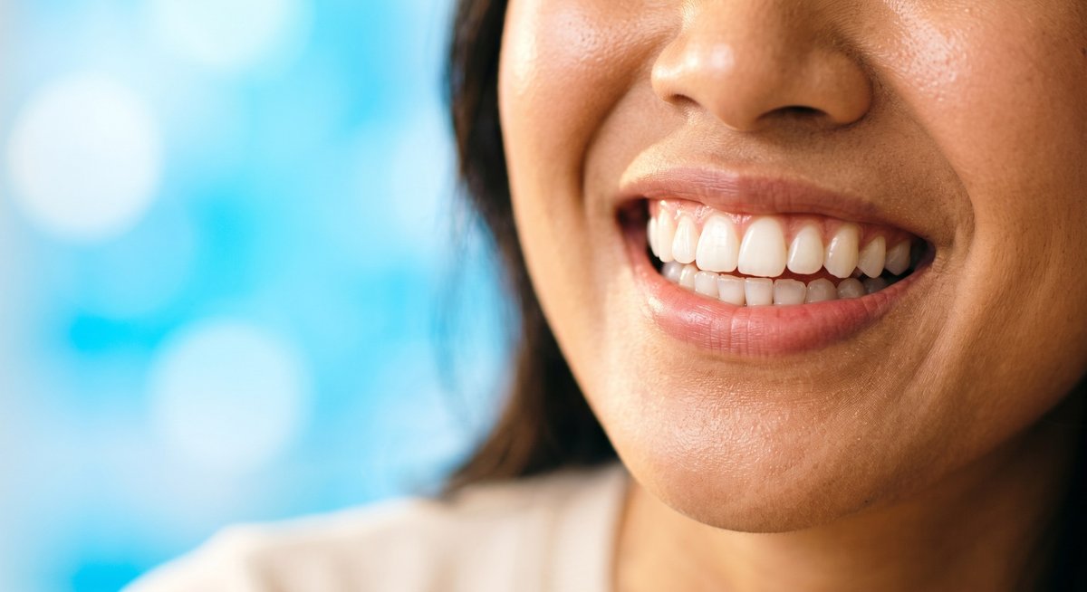Senyum cerah pasien wanita setelah perawatan gigi di DENTISKU Subang